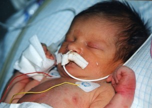 Xavier à la naissance