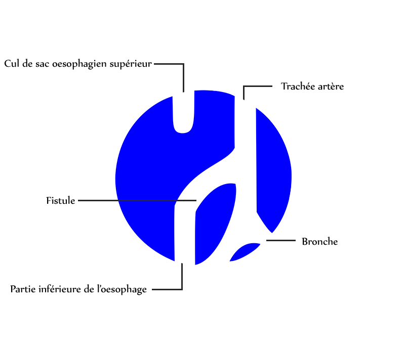 Explication logo